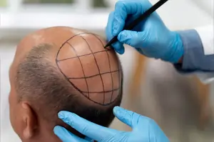 Hydra Facial